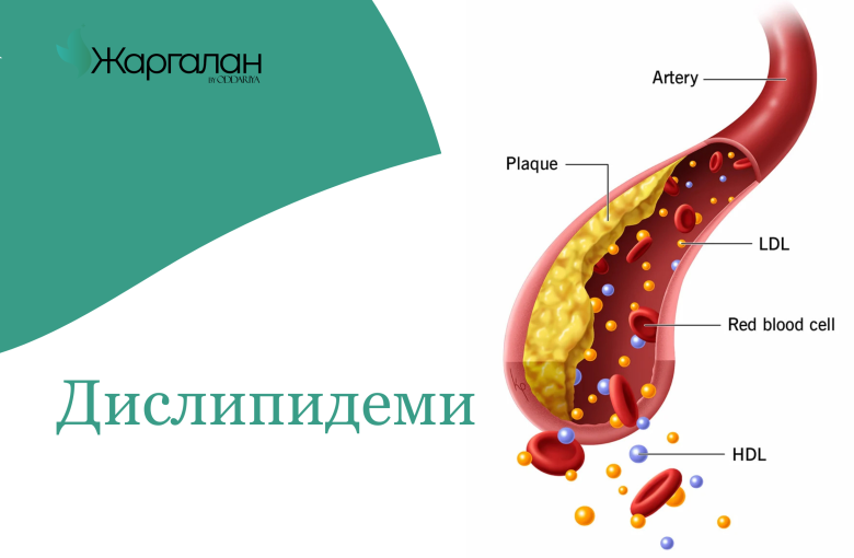 Насанд хүрэгчдийн дислипидемийн оношилгоо, эмчилгээний менежмент цогц сургалт